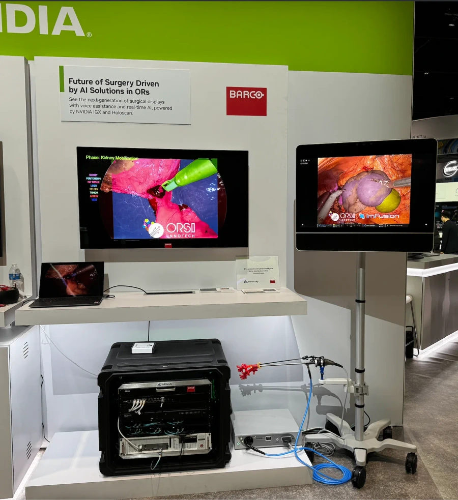Smart surgical display with built in LLM and NVIDIA compute